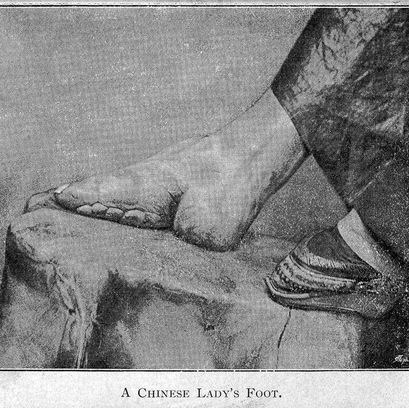 Illustration of foot binding