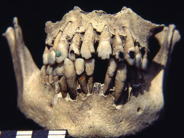 Mayan jeweled teeth